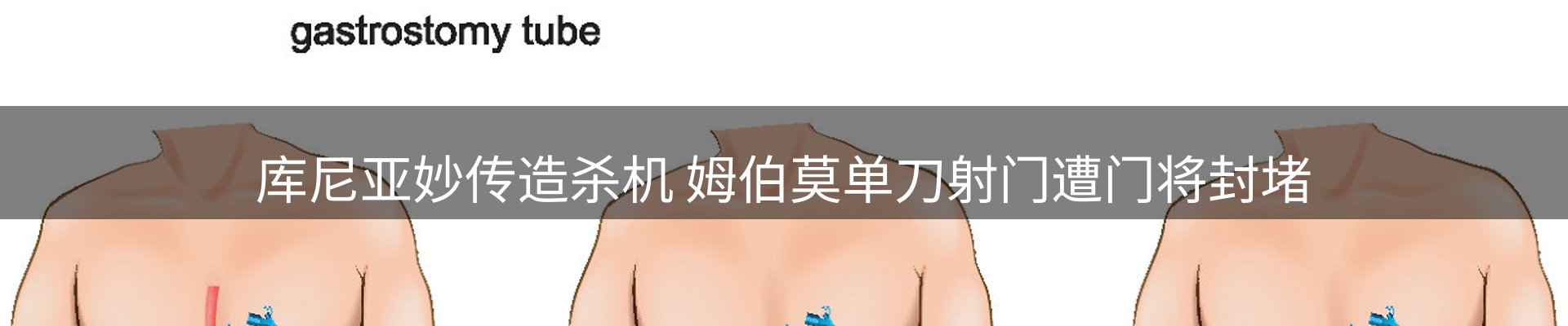 平台资讯